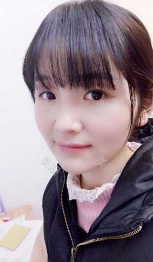 ¥3800双眼皮长沙美之峰
