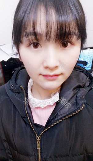 ¥3800双眼皮长沙美之峰