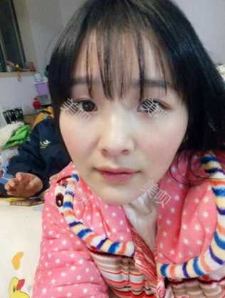 ¥3800双眼皮长沙美之峰