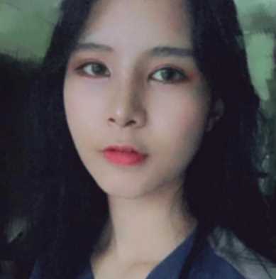 隆鼻术后29天的*果图