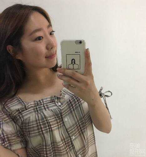 做完*,我的皮肤是不是看着很好呀
