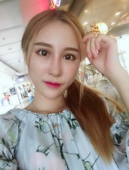 南京*整形第十二天