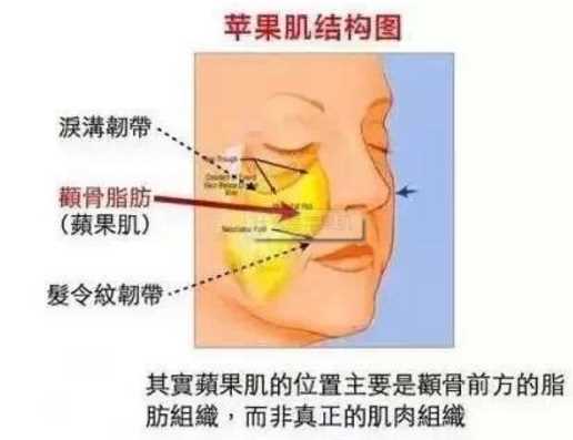 关之琳复出颜绝美？高耸的苹果肌太突兀