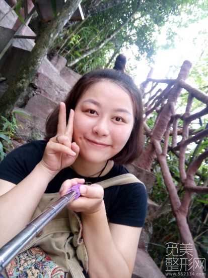 **术后一个月了