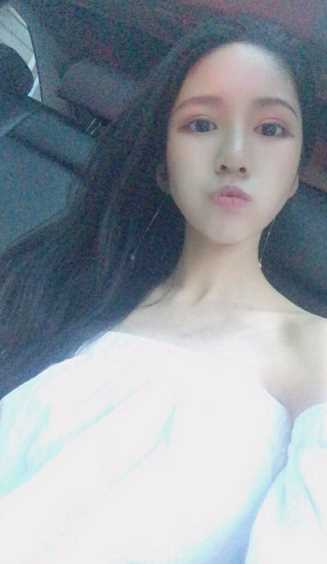 自体脂肪填充额头术后案例 自体脂肪填充额头术后案例