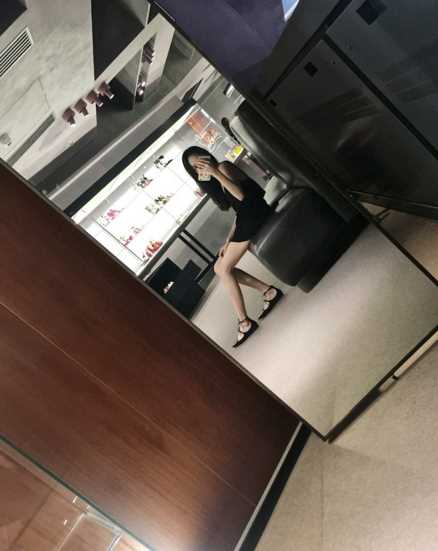 自体脂肪填充额头术后案例 自体脂肪填充额头术后案例