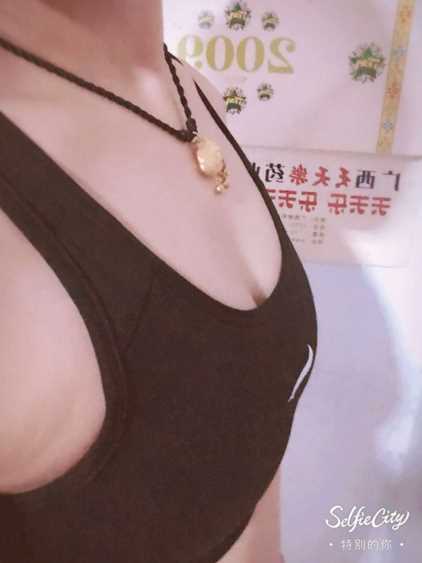 自体脂肪隆胸 哇偶!快一个月了呢