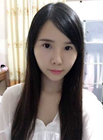 大家好,现在做的鼻翼缩小已经将近两个月了