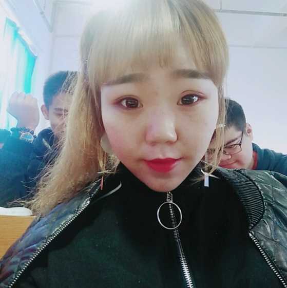 打*术后已经是第12天啦,开心
