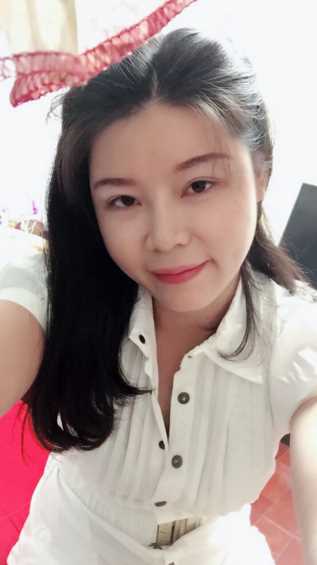 做完自体脂肪填充面部后,已经一个月了~