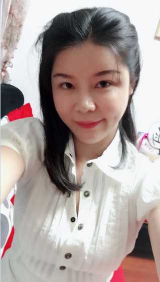 做完自体脂肪填充面部后,已经一个月了~