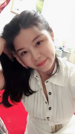 做完自体脂肪填充面部后,已经一个月了~