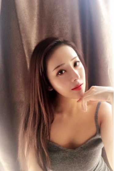 隆鼻修复 术后35天
