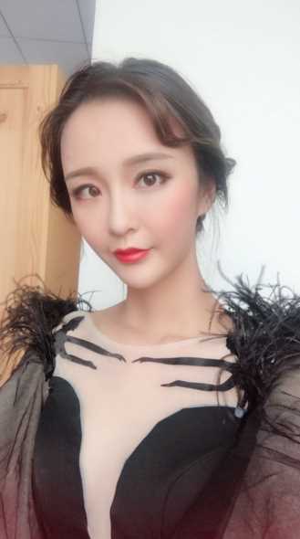 自体脂肪全脸填充术后第133天
