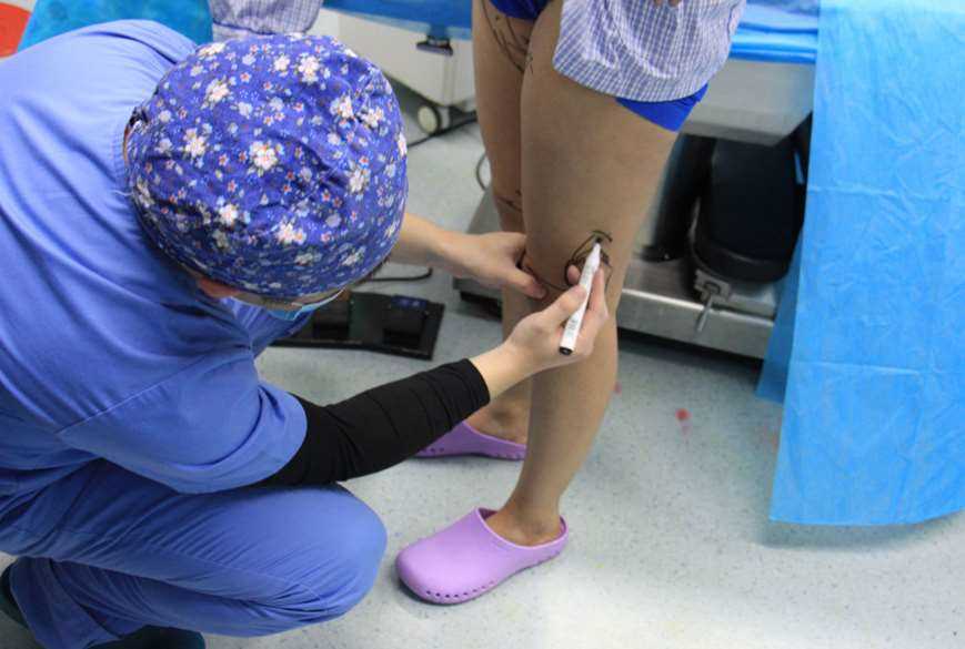 假体隆胸 臀下吸脂 大腿吸脂 小腿吸脂当天