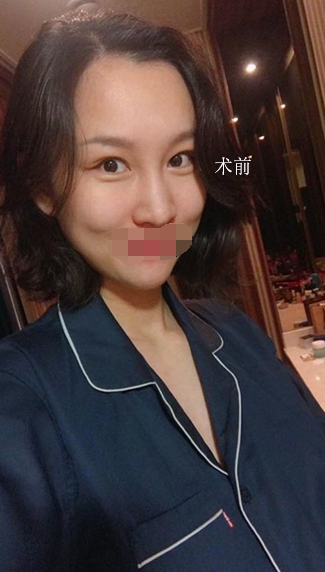 终于打了*,第一次尝试