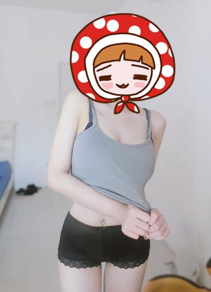 北京自体脂肪隆胸 案例图 价格表
