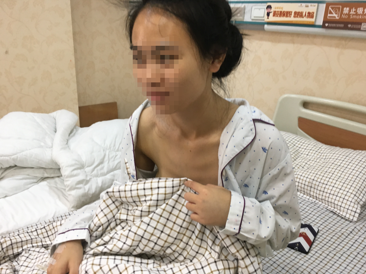 假体隆胸手术过程进行的挺顺利