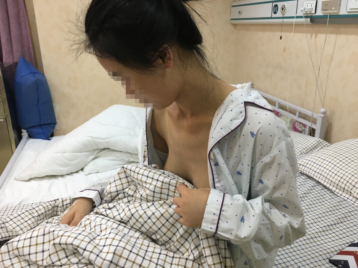 假体隆胸手术过程进行的挺顺利