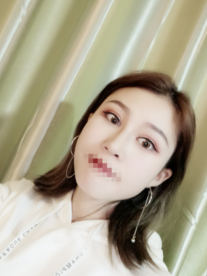 吸脂瘦腰腹