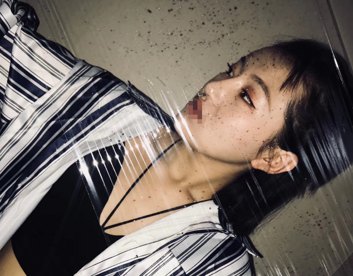北京综合隆鼻*果图 价格多少钱