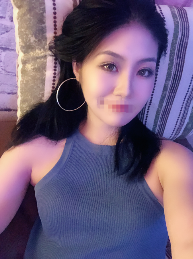 南京双眼皮修复*果图 鼓楼医院整形科怎么样？