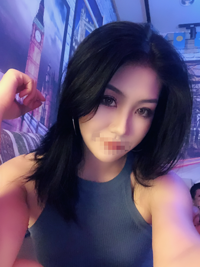 南京双眼皮修复*果图 鼓楼医院整形科怎么样？