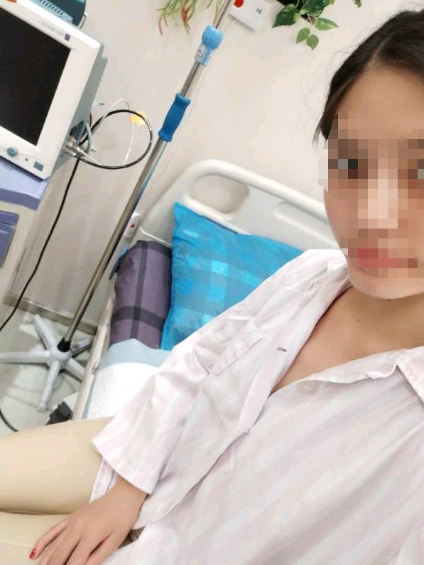 重庆好美医疗美容 医生：罗海军 吸脂瘦大腿 案例图投稿分享