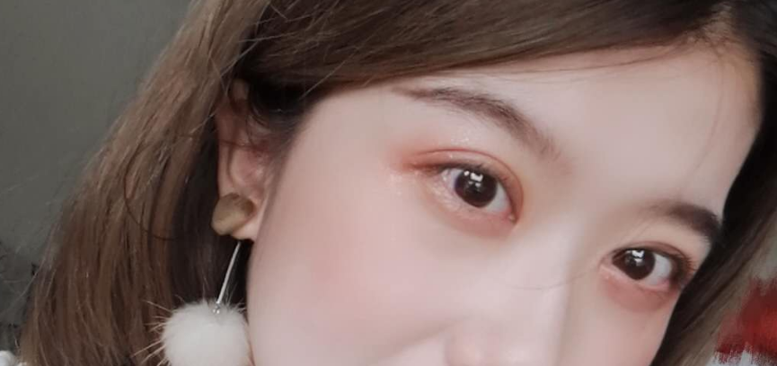 【全切双眼皮微创开眼角案例图】上海九院整形科朱海男 王梓 黄如林 苏薇洁 周一雄 谢峰 双眼皮技术怎么样？