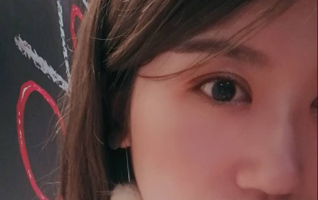 【全切双眼皮微创开眼角案例图】上海九院整形科朱海男 王梓 黄如林 苏薇洁 周一雄 谢峰 双眼皮技术怎么样？