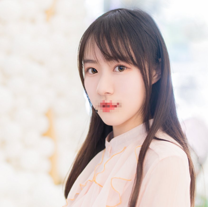 切开双眼皮术后第54天 双眼皮宛如天生的一样