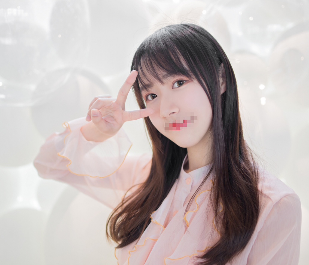 切开双眼皮术后第54天 双眼皮宛如天生的一样
