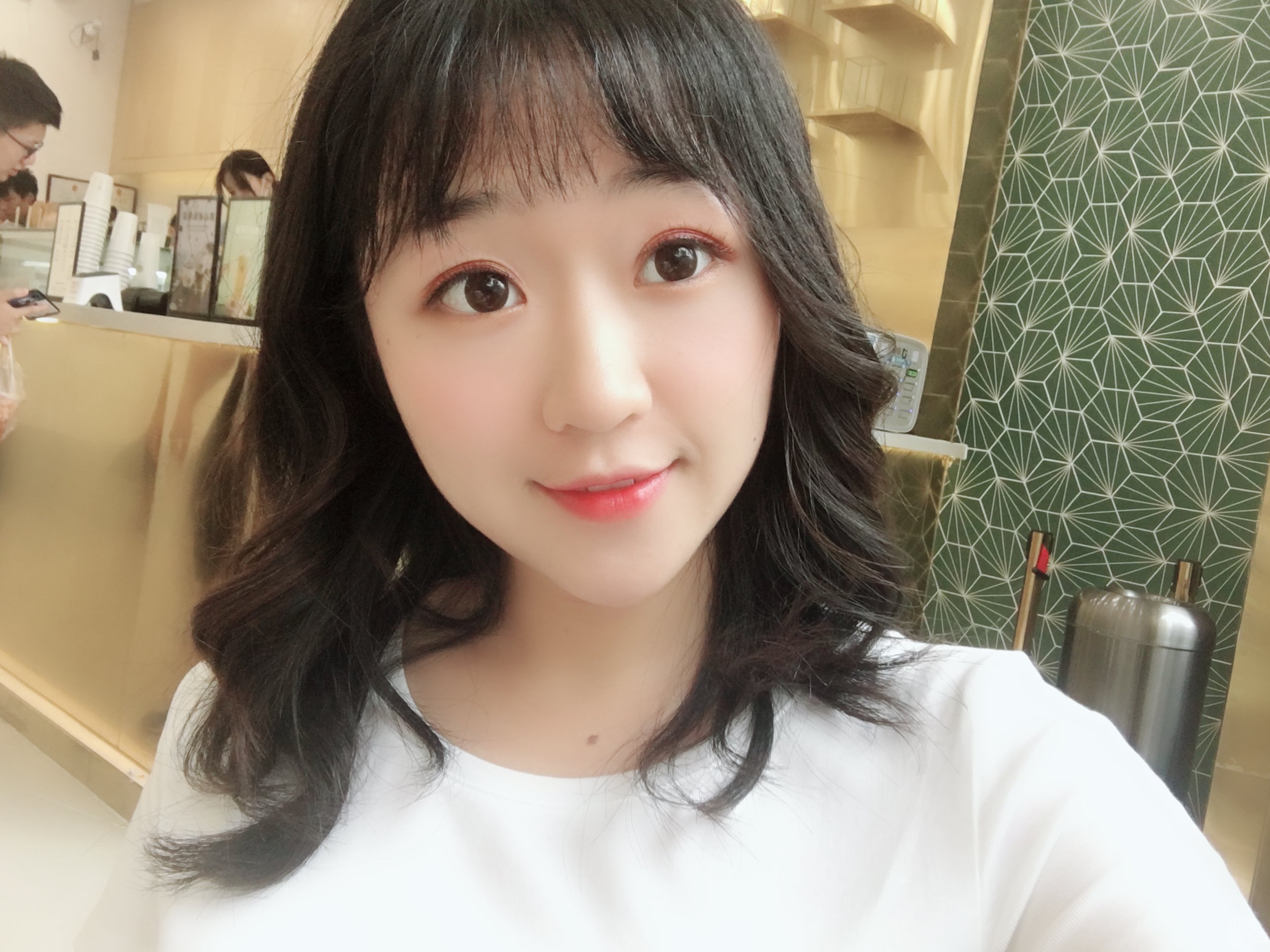 广州东莞做的自体脂肪全脸填充术后第10天感觉恢复的好快呀