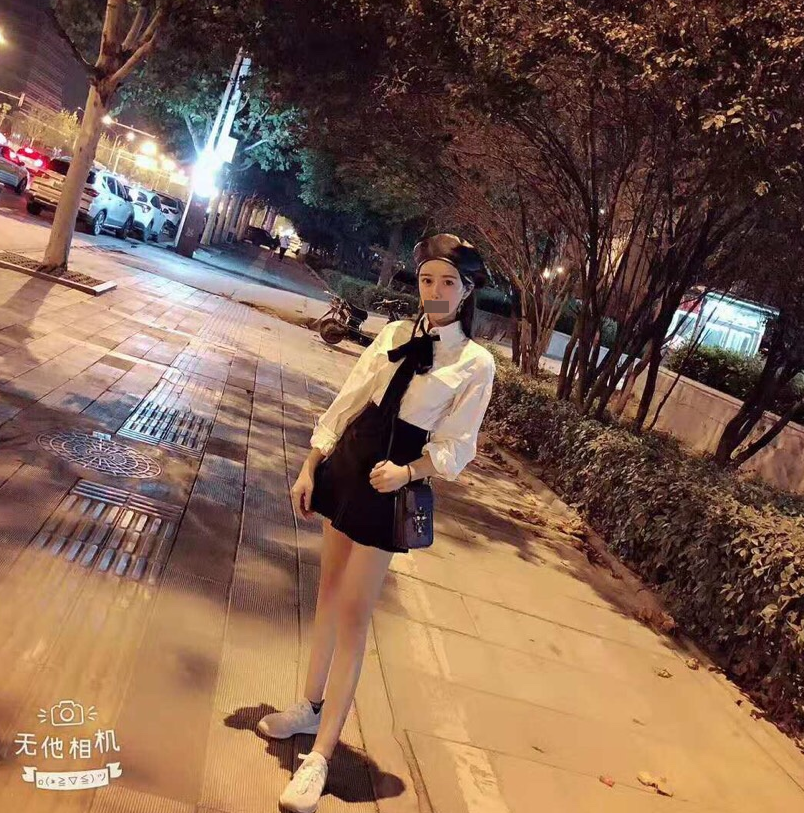 硅胶隆鼻 武汉做鼻子一年多了