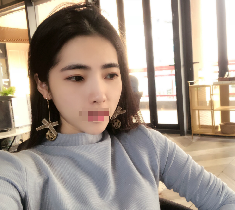 在觅美己预约了医院做完*现在都快一个月了