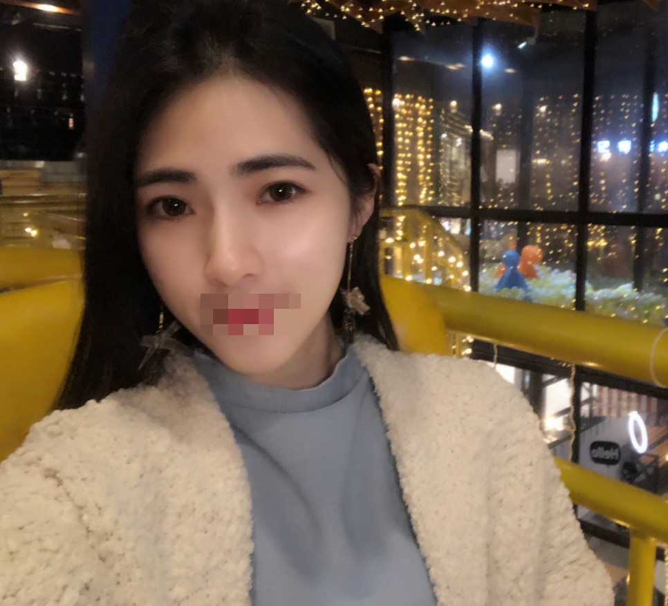 在觅美己预约了医院做完*现在都快一个月了