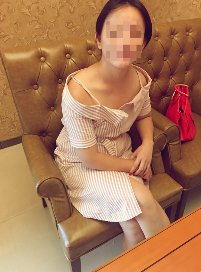 假体隆胸术后当然觅美网上找了很久才找到一家心仪的医院