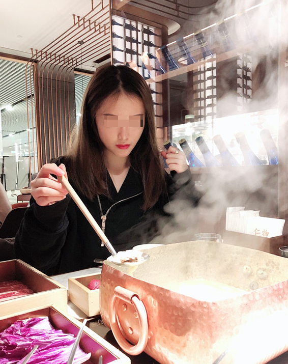 北京做的玻尿酸垫下巴术后第24天
