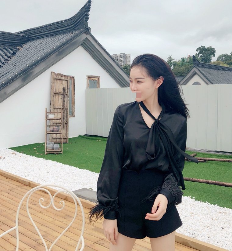 杭州综合隆鼻术后一个半月 价格:38800