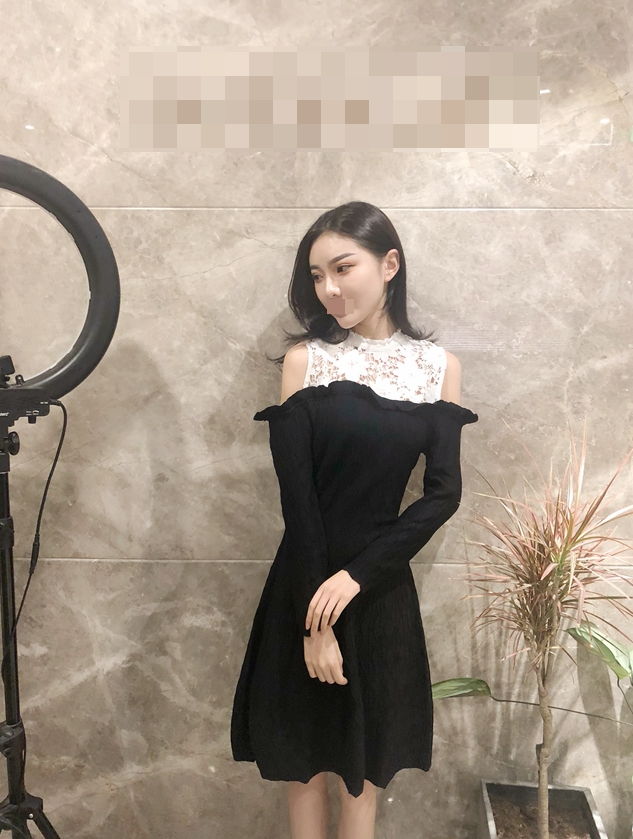 杭州综合隆鼻术后一个半月 价格:38800