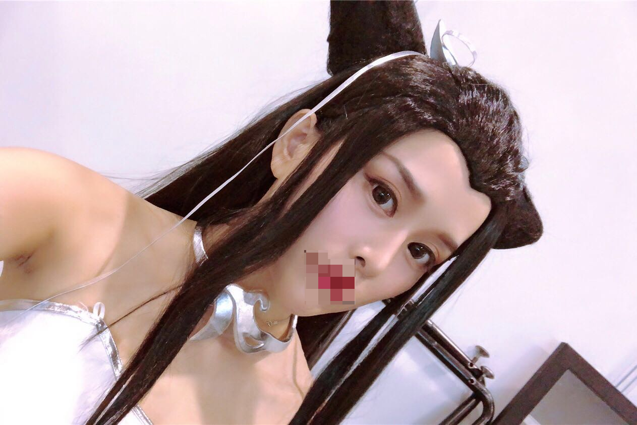 *术后128天¥6666 杭州艺星割双眼皮怎么样 案例好看吗