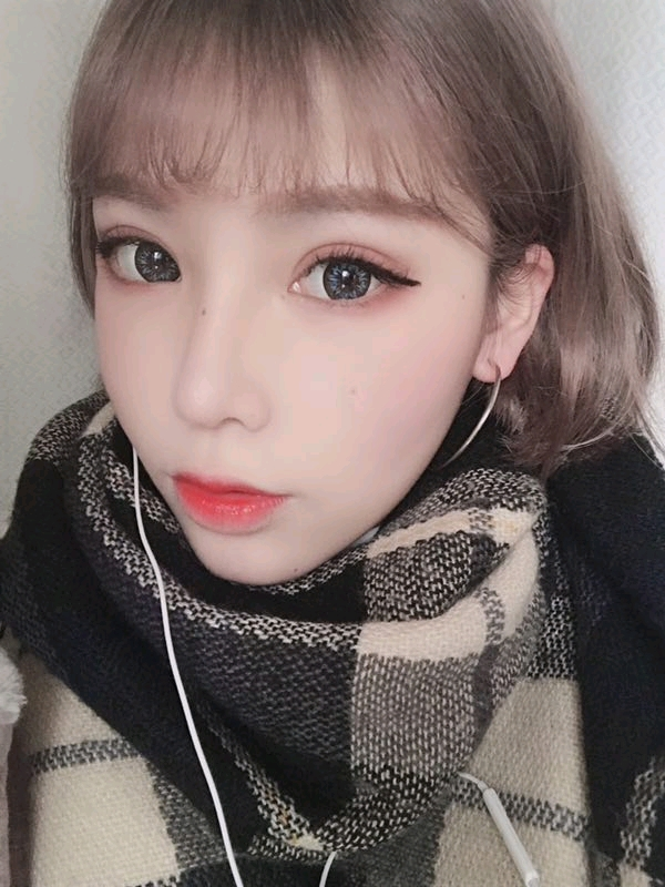 综合隆鼻转眼都过去好几个月了…过得真快啊。重庆精美整形田永华隆鼻案例图怎么样?好看吗