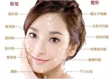 无需开刀仅仅依靠微整形就能提升你颜值的项目有哪些?