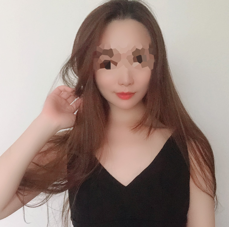 听人家说,男要俏,一身皂;女要俏 成都华西口腔医院罗恩、李继华磨骨谁做的好?【案例图】