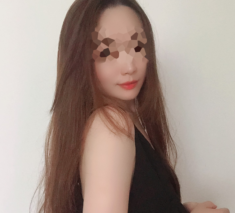 听人家说,男要俏,一身皂;女要俏 成都华西口腔医院罗恩、李继华磨骨谁做的好?【案例图】