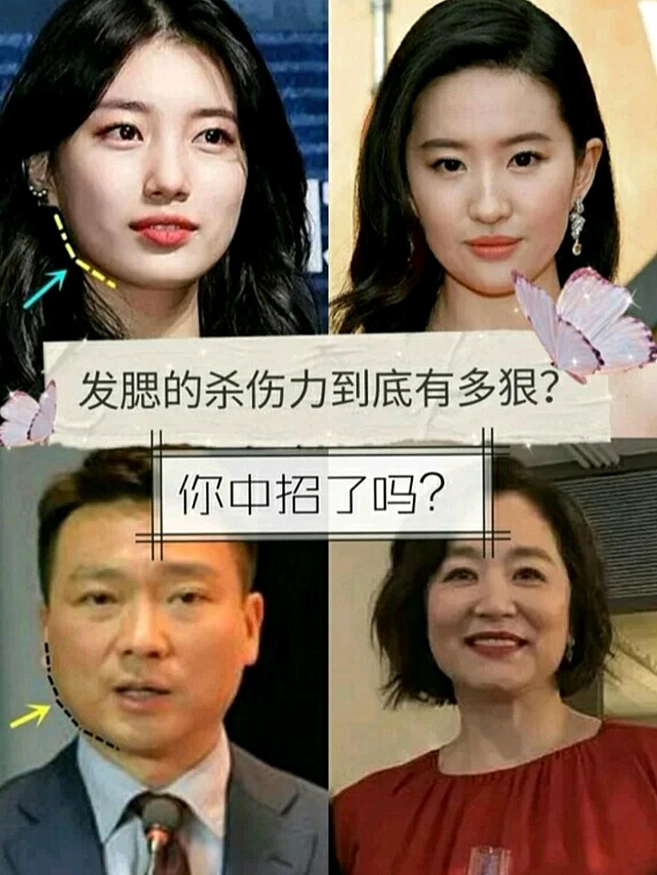 发腮”的杀伤力到底有多狠?下颌明X变得方钝,脸比以前大不止一倍!