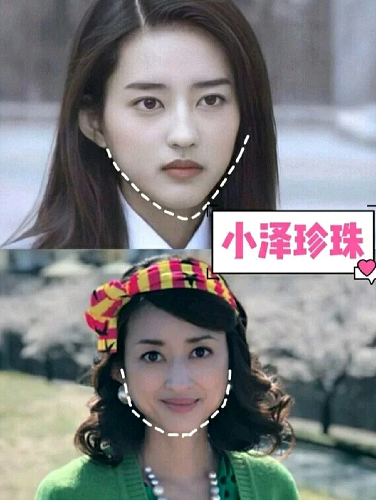 发腮”的杀伤力到底有多狠?下颌明X变得方钝,脸比以前大不止一倍!