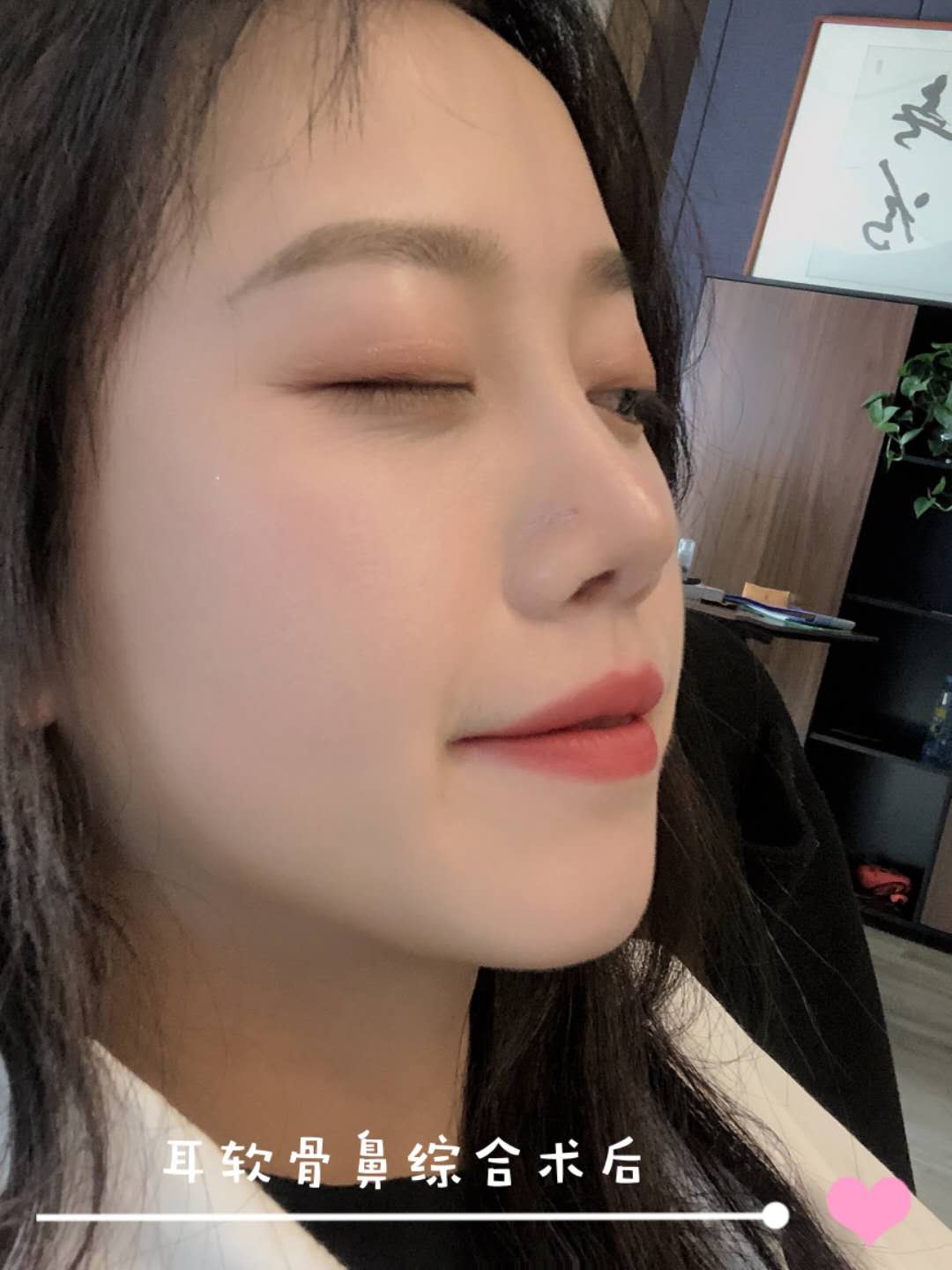 自从做了隆鼻,我就一直没怎么吃辣,尤其刚开始,真的一丁点辣的也不敢碰