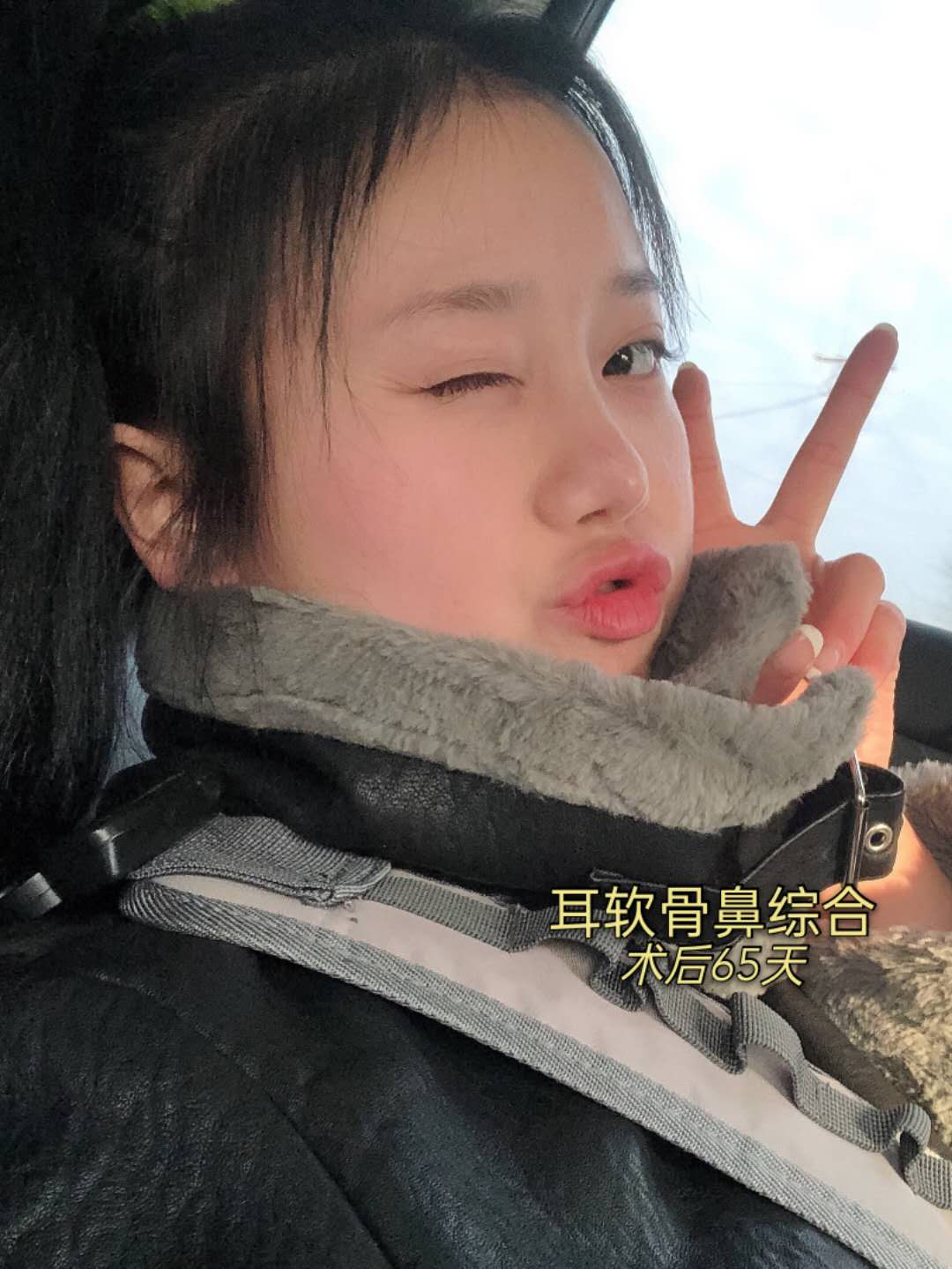 自从做了隆鼻,我就一直没怎么吃辣,尤其刚开始,真的一丁点辣的也不敢碰