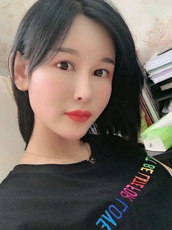 只要额头变得扁平,侧颜看起来 不言而喻 北京东方和谐自体脂肪填充多少钱?冯斌怎么样?【点击咨询】